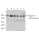 Type I 4-phosphatase Antibody (D-10) - Western Blotting - Image 371150 
