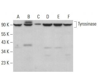 Tyrosinase Antibody (0.N.596) - Western Blotting - Image 379978The Double Nickase Plasmid features a U6 promoter for sgRNA expression, a 20 nt targeting sequence, and a gRNA scaffold to guide Cas9n. It includes a CBh promoter for Cas9n (D10A) and puromycin resistance, GFP for transfection verification, and nuclear localization signals (NLS). The 2A peptide allows co-expression of Cas9n and Puro from a single promoter, enabling precise genome editing with reduced off-target effects.