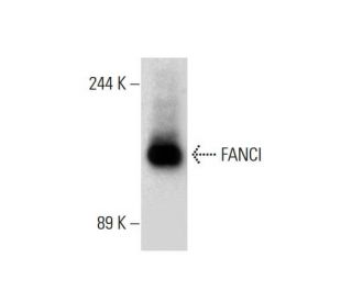 FANCI Antibody (A-7) - Western Blotting - Image 132724 