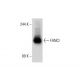 FANCI Antibody (A-7) - Western Blotting - Image 132724 