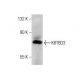KBTBD3 (K-15): sc-247218. Western blot analysis of KBTBD3 expression in U-2 OS whole cell lysate.