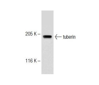 U-87 MG Cell Lysate: sc-2411. Western blot analysis of tuberin... 