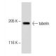 U-87 MG Cell Lysate: sc-2411. Western blot analysis of tuberin... 
