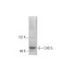 U-937 nuclear extract: sc-2156. Western blot analysis of CHD1L expression...