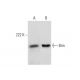 U-937 nuclear extract: sc-2156. Western blot analysis of Brm expression... 
