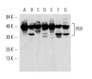 U-937 + PMA Cell Lysate: sc-2296. Western blot analysis of... 