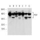U-937 + PMA Cell Lysate: sc-2296. Western blot analysis of... 