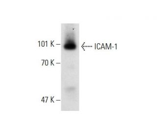 U-937 + TNF alpha Cell Lysate: sc-2297. Western blot analysis of... 