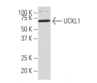 UCKL1 Antibody (SY-16) - Western Blotting - Image 34007