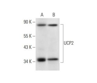UCP2 Antibody (G-6) - Western Blotting - Image 326512Each CRISPR/Cas9 Knockout (KO) Plasmid product consists of a pool of 3 plasmids designed to ensure identification and cleavage of a specific gene for maximum knockout efficiency. Each plasmid encodes a unique 20 nt sequence derived from the GeCKO (v2) library.
