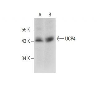 UCP4 Antibody (A-5) - Western Blotting - Image 139095The Double Nickase Plasmid features a U6 promoter for sgRNA expression, a 20 nt targeting sequence, and a gRNA scaffold to guide Cas9n. It includes a CBh promoter for Cas9n (D10A) and puromycin resistance, GFP for transfection verification, and nuclear localization signals (NLS). The 2A peptide allows co-expression of Cas9n and Puro from a single promoter, enabling precise genome editing with reduced off-target effects.