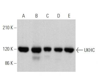 UKHC Antibody (F-5) - Western Blotting - Image 359752 