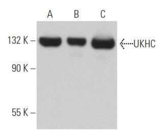 UKHC Antibody (F-9) - Western Blotting - Image 363590 