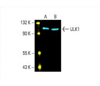 ULK1 Antibody (F-4) - Western Blotting - Image 393435 