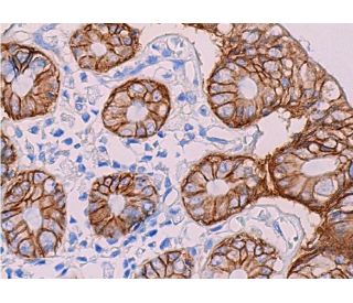 &beta;-catenin (E-5): sc-7963. Immunoperoxidase staining of formalin fixed, paraffin-embedded human rectum tissue showing membr 