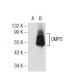 UMPS Antibody (3H6) - Western Blotting - Image 125667