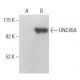 UNC45A Antibody (AbS1) - Western Blotting - Image 398893 