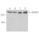 UNC5H3 Antibody (F-4) - Western Blotting - Image 363241 