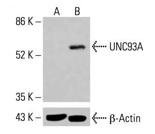UNC93A Antibody (F-2) - Western Blotting - Image 415020 