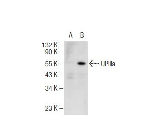 UPIIIa (F-11): sc-166598. Western blot analysis of UPIIIa expression in... 