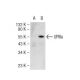 UPIIIa (F-11): sc-166598. Western blot analysis of UPIIIa expression in... 