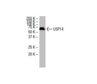 USP14 Antibody (6E6) - Western Blotting - Image 34001 