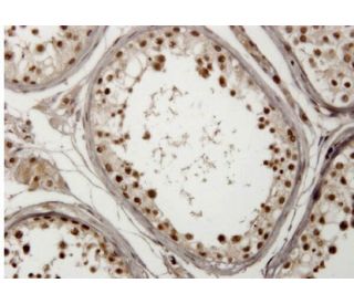 USP29 Antibody (1A8) - Immunohistochemistry - Image 351783 
