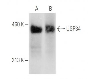 USP34 Antibody (3H9) - Western Blotting - Image 308631SAM Transcription Activation: SAM system utilizing dCas9-VP64, MS2-P65-HSF1, and sgRNA for precise gene transcription activation.