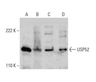 USP52 Antibody (6A7) - Western Blotting - Image 384447 