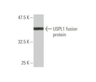 USPL1 Antibody (2F12) - Western Blotting - Image 349018