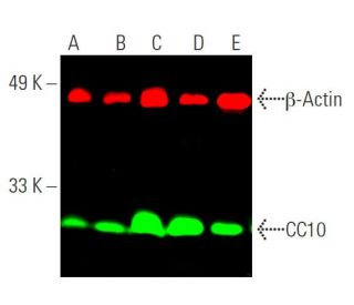 Uteroglobin/SCGB1A1/CC10 Antibody (E-11) - Western Blotting - Image 385955The Double Nickase Plasmid features a U6 promoter for sgRNA expression, a 20 nt targeting sequence, and a gRNA scaffold to guide Cas9n. It includes a CBh promoter for Cas9n (D10A) and puromycin resistance, GFP for transfection verification, and nuclear localization signals (NLS). The 2A peptide allows co-expression of Cas9n and Puro from a single promoter, enabling precise genome editing with reduced off-target effects.
