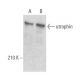 utrophin Antibody (A-7) - Western Blotting - Image 354491 