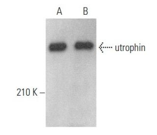 utrophin Antibody (MANCHO7) - Western Blotting - Image 354496 