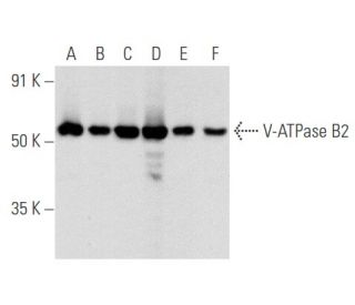 V-ATPase B2 Antibody (C-9) - Western Blotting - Image 356617 