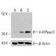 V-ATPase D 抗体(E-12):sc-390384。通过蛋白质印迹分析未处理(A)和经化学处理(B、C)的K-562完整细胞裂解物中V-ATPase D的表达。β-肌动蛋白(C4):sc-47778用作加载对照。使用的检测试剂:m-IgG Fc BP-HRP:sc-525409。 V-ATPase D Antibody (E-12) - Western Blotting - Image 415060