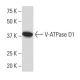 V-ATPase D1 Antibody (34-Z) - Western Blotting - Image 33537 