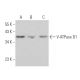 V-ATPase D1 Antibody (D-4) - Western Blotting - Image 371625