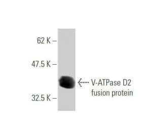 V-ATPase D2 Antibody (7A4) - Western Blotting - Image 350357