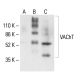 VAChT Antibody (H-10) - Western Blotting - Image 411254