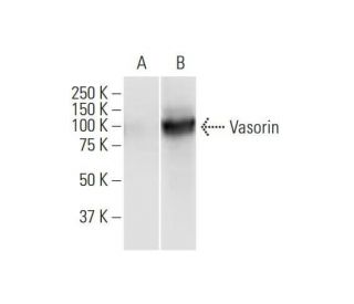 Vasorin Antibody (4G7) - Western Blotting - Image 352228 