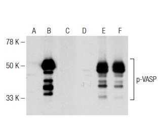 VASP Antibody (A-11) - Western Blotting - Image 142640 