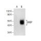 VASP Antibody (D-11) - Western Blotting - Image 154818
