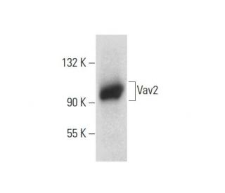 Vav2 Antibody (F-6) - Western Blotting - Image 134495Each CRISPR/Cas9 Knockout (KO) Plasmid product consists of a pool of 3 plasmids designed to ensure identification and cleavage of a specific gene for maximum knockout efficiency. Each plasmid encodes a unique 20 nt sequence derived from the GeCKO (v2) library.