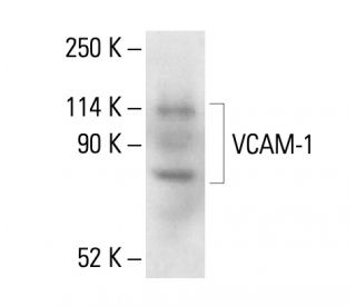 VCAM-1 Antibody (1.BB.619) - Western Blotting - Image 411252 