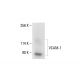 VCAM-1 Antibody (1.BB.619) - Western Blotting - Image 412017
