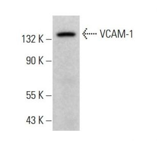VCAM-1 Antibody (1G11) - Western Blotting - Image 380607 