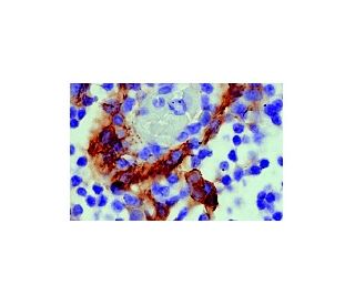 VCAM-1 Antibody (E-10) - Immunohistochemistry - Image 5074 