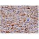 VCAM-1 Antibody (HAE-2z) - Immunohistochemistry - Image 284911