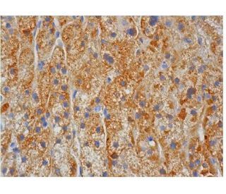 VCAM-1 Antibody (P3C4) - Immunohistochemistry - Image 284766 