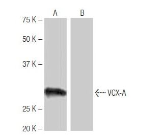 VCX-A Antibody (AL-78) - Western Blotting - Image 65093